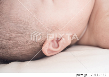 耳瘻孔の赤ちゃん 79112835
