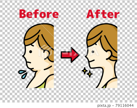 Double chin woman and slim face line woman 79116044