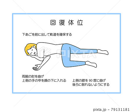 日本語版【図解】回復体位のやり方 シンプルなイラスト ベクター 79131181