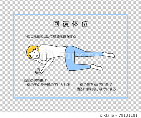 日本語版【図解】回復体位のやり方 シンプルなイラスト ベクター 79131181