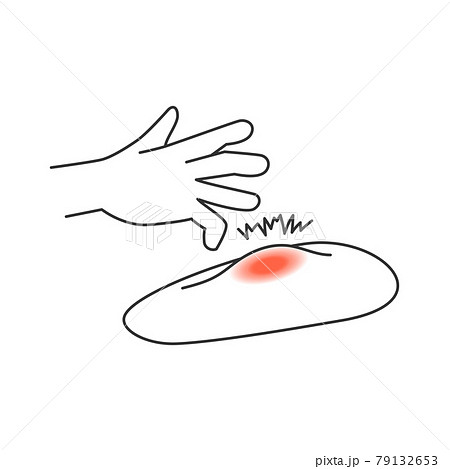 蚊に刺されて痒い肌のイラスト素材 蚊に刺されて痒い肌のイラスト素材