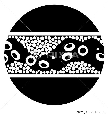 Cholesterol and atherosclerosis 79162896