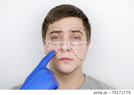 A man at the reception at the plastic surgeon. Before plastic surgery: eyebrow, forehead, chin and cheek lift 79171779