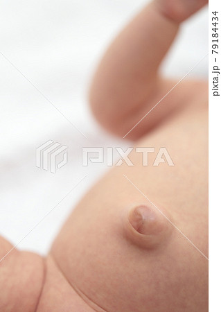 臍ヘルニアの赤ちゃんのおへそ 79184434