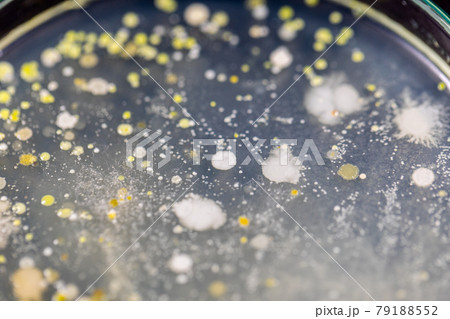 Backgrounds of Characteristics and Different shaped Colony of Bacteria and Mold growing on agar plates from Soil samples for education in Microbiology laboratory. 79188552