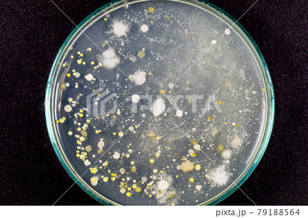 Backgrounds of Characteristics and Different shaped Colony of Bacteria and Mold growing on agar plates from Soil samples for education in Microbiology laboratory. Backgrounds of Characteristics and Different shaped Colony of Bacteria and Mold growing on agar plates from Soil samples for education in Microbiology laboratory. 79188564