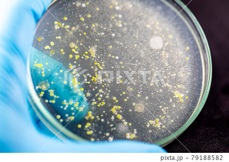 Backgrounds of Characteristics and Different shaped Colony of Bacteria and Mold growing on agar plates from Soil samples for education in Microbiology laboratory. Backgrounds of Characteristics and Different shaped Colony of Bacteria and Mold growing on agar plates from Soil samples for education in Microbiology laboratory. 79188582