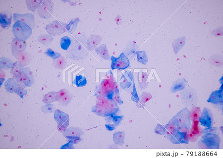 Characteristics of anatomy and Histological sample Squamous epithelial cells under microscope, Human and isolated Cell. Characteristics of anatomy and Histological sample Squamous epithelial cells under microscope, Human and isolated Cell. 79188664