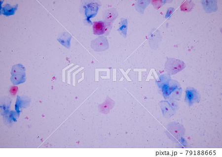 Characteristics of anatomy and Histological sample Squamous epithelial cells under microscope, Human and isolated Cell. Characteristics of anatomy and Histological sample Squamous epithelial cells under microscope, Human and isolated Cell. 79188665