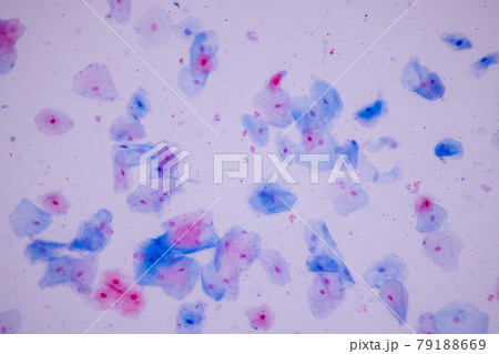 Characteristics of anatomy and Histological sample Squamous epithelial cells under microscope, Human and isolated Cell. Characteristics of anatomy and Histological sample Squamous epithelial cells under microscope, Human and isolated Cell. 79188669