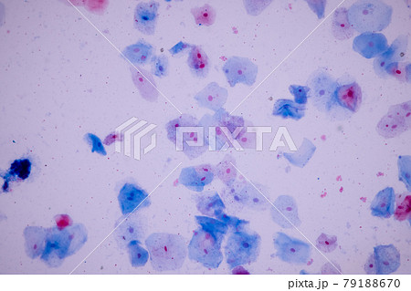 Characteristics of anatomy and Histological sample Squamous epithelial cells under microscope, Human and isolated Cell. Characteristics of anatomy and Histological sample Squamous epithelial cells under microscope, Human and isolated Cell. 79188670