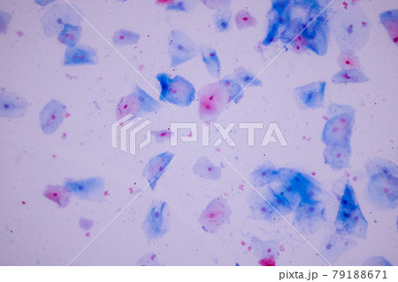Characteristics of anatomy and Histological sample Squamous epithelial cells under microscope, Human and isolated Cell. Characteristics of anatomy and Histological sample Squamous epithelial cells under microscope, Human and isolated Cell. 79188671