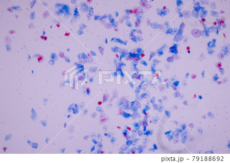 Characteristics of anatomy and Histological sample Squamous epithelial cells under microscope, Human and isolated Cell. Characteristics of anatomy and Histological sample Squamous epithelial cells under microscope, Human and isolated Cell. 79188692