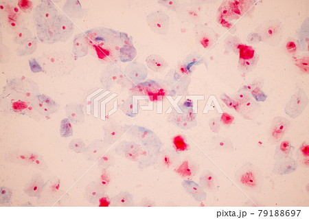 Characteristics of anatomy and Histological sample Squamous epithelial cells under microscope, Human and isolated Cell. Characteristics of anatomy and Histological sample Squamous epithelial cells under microscope, Human and isolated Cell. 79188697
