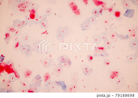 Characteristics of anatomy and Histological sample Squamous epithelial cells under microscope, Human and isolated Cell. Characteristics of anatomy and Histological sample Squamous epithelial cells under microscope, Human and isolated Cell. 79188698