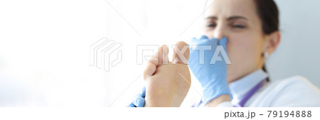 Doctor covers nose from unpleasant smell from male leg Doctor covers nose from unpleasant smell from male leg 79194888