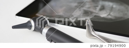 An otoscope with an X-ray is on table 79194900