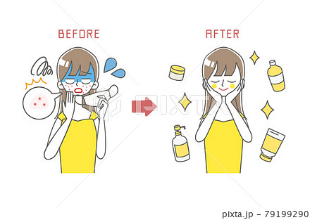 肌荒れに困る女性のBEFORE/AFTERイラスト 79199290