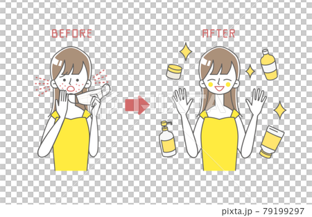 マスクによる肌荒れに困る女性のBEFORE/AFTERイラスト マスクによる肌荒れに困る女性のBEFORE/AFTERイラスト 79199297