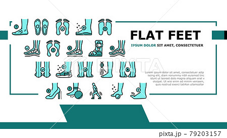 Flat Feet Disease Landing Header Vector Flat Feet Disease Landing Header Vector 79203157