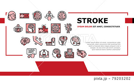 Stroke Health Problem Landing Header Vector 79203202