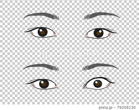 甲狀腺眼病（格雷夫斯眼病）與正常眼的對比圖 79208130