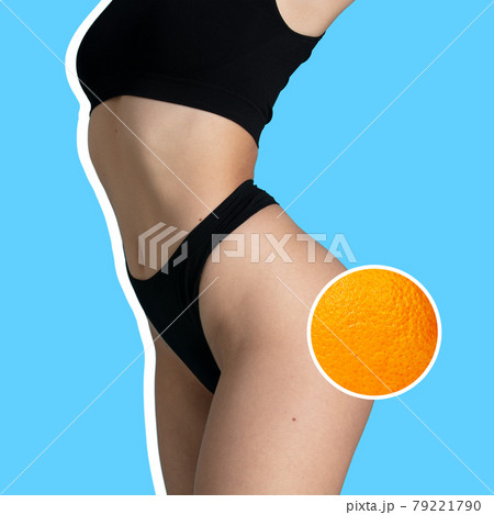 Young woman with orange on blue background. Cellulite and problem skin concept. 79221790