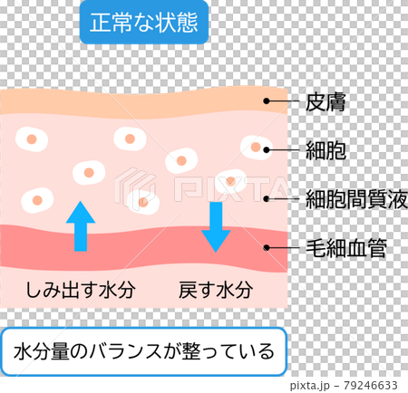 正常な肌 水分のバランスの整った状態 断面図 正常な肌 水分のバランスの整った状態 断面図 79246633