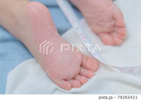 赤ちゃんの足とメジャー 赤ちゃんの足とメジャー 79263421