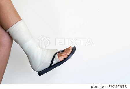 The leg with the cast rests on the knee of the other leg. The leg with the cast rests on the knee of the other leg. 79295958