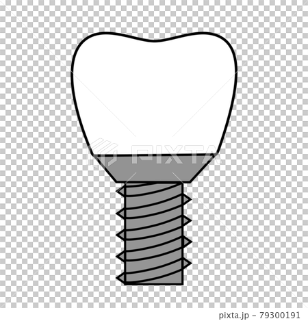 Illustration of implant Illustration of implant 79300191