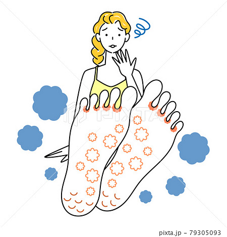 スキンケア 足が水虫になってしまい悲しんでいる可愛い女性 足裏のアップ イラスト ベクターのイラスト素材