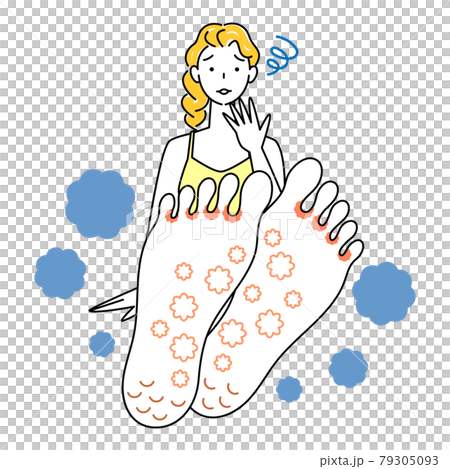 護膚 可愛的女人，因為她的腳是運動員的腳而感到悲傷 向上她腳底的插圖矢量 79305093