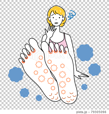 スキンケア 足が水虫になってしまい悲しんでいる可愛い女性 足裏のアップ イラスト ベクターのイラスト素材