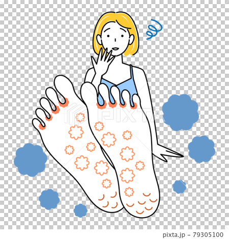 スキンケア 足が水虫になってしまい悲しんでいる可愛い女性 足裏のアップ イラスト ベクター 79305100