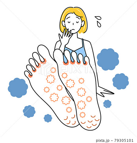 スキンケア 足が水虫になってしまい悲しんでいる可愛い女性 足裏のアップ イラスト ベクターのイラスト素材