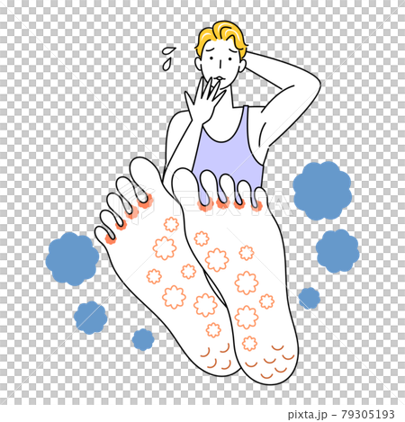 スキンケア 足が水虫になってしまい悲しんでいる可愛い男性 足裏のアップ イラスト ベクター 79305193