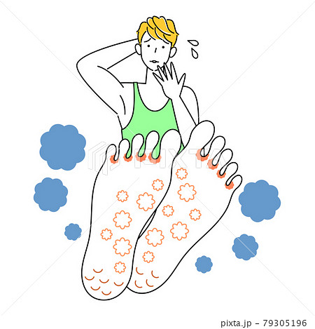 スキンケア 足が水虫になってしまい悲しんでいる可愛い男性 足裏のアップ イラスト ベクターのイラスト素材