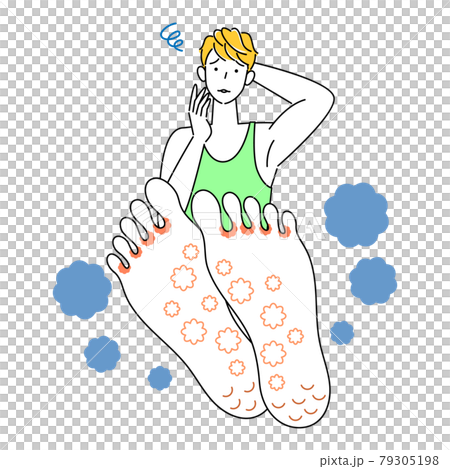 Skin care Cute man who is sad because his feet are athlete's foot Up illustration vector of the soles of his feet 79305198