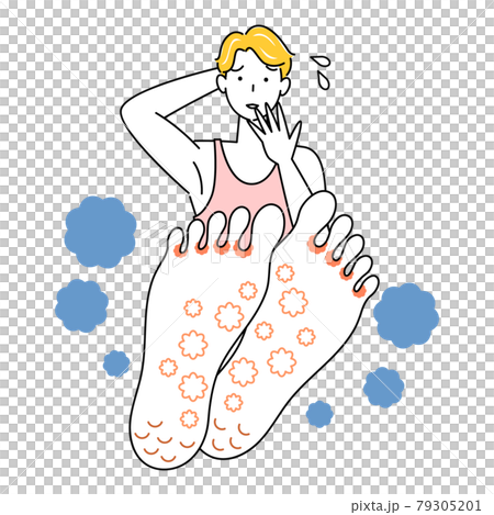 Skin care Cute man who is sad because his feet are athlete's foot Up illustration vector of the soles of his feet Skin care Cute man who is sad because his feet are athlete's foot Up illustration vector of the soles of his feet 79305201