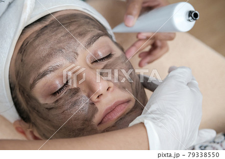 Close up of cosmetologist applying black mask on the face of a beautiful woman for carbon peel. Hardware cosmetology treatment. Close up of cosmetologist applying black mask on the face of a beautiful woman for carbon peel. Hardware cosmetology treatment. 79338550