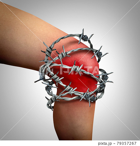 Knee Joint Pain 79357267