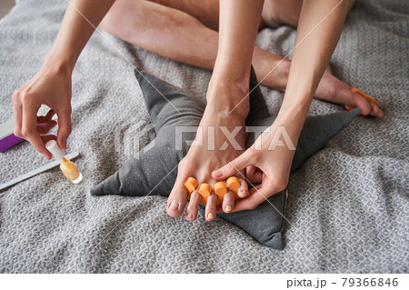 Woman with vitiligo disease applying colored nail polish at the bed at home Woman with vitiligo disease applying colored nail polish at the bed at home 79366846