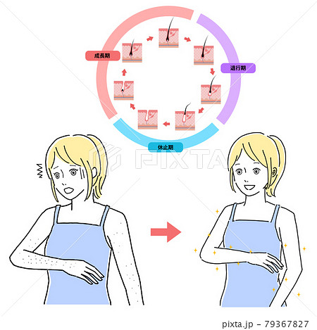 脱毛イメージ女性 脱毛イメージ女性 79367827