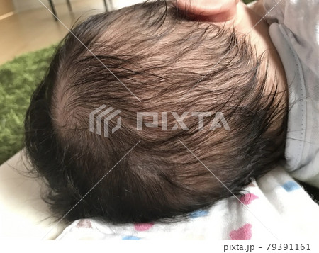 赤ちゃんが寝ている後ろ頭 赤ちゃんが寝ている後ろ頭 79391161