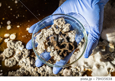 Hands in blue medical gloves hold a petri dish with mold inside. Scientific experiments, experiments in the laboratory Hands in blue medical gloves hold a petri dish with mold inside. Scientific experiments, experiments in the laboratory 79435638