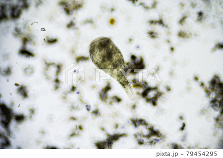 Ciliates Stentor found in freshwater pond under the light microscope 79454295