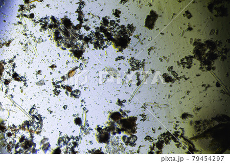 Stylonichia mytilus and microalgae under the light microscope 79454297