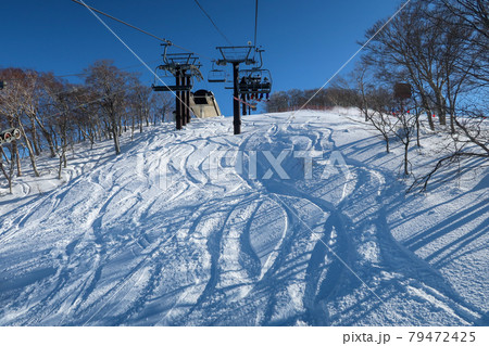晴天の日本のスキーリゾート 晴天の日本のスキーリゾート 79472425