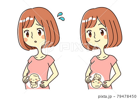 妊婦 逆子 イラスト 妊婦 逆子 イラスト 79478450
